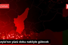 leylanin-yuzu-doku-nakliyle-gulecek-6ZCCcsez.jpg