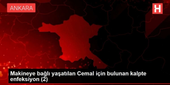 makineye-bagli-yasatilan-cemal-icin-bulunan-kalpte-enfeksiyon-2-QWHSxUdp.jpg