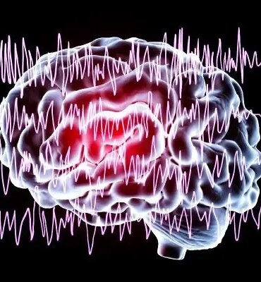 3-epilepsi-hastasindan-2si-is-bulmakta-zorlaniyor-VPUBvAYS.jpg