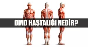 dmd-hastaligi-nedir-dmd-belirtileri-nelerdir-tedavisi-var-mi-F9U5AmcQ.jpg
