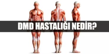 dmd-hastaligi-nedir-dmd-belirtileri-nelerdir-tedavisi-var-mi-F9U5AmcQ.jpg