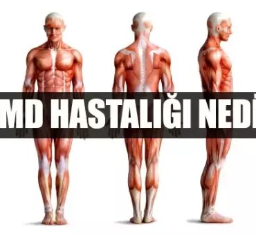 dmd-hastaligi-nedir-dmd-belirtileri-nelerdir-tedavisi-var-mi-F9U5AmcQ.jpg