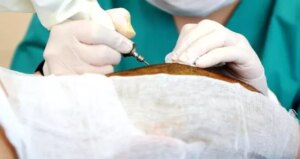 en-duzgun-sac-ekim-klinikleri-NTYe2TZg.jpg
