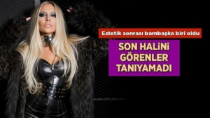 estetik-sonrasi-bambaska-biri-oldu-gulsah-saracoglunu-gorenler-taniyamadi-MR2jvR6H.jpg