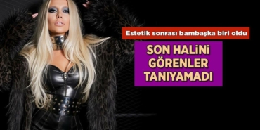 estetik-sonrasi-bambaska-biri-oldu-gulsah-saracoglunu-gorenler-taniyamadi-MR2jvR6H.jpg