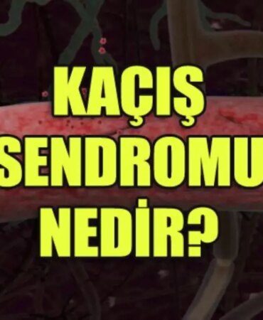 kacis-sendromu-nedir-belirtileri-nelerdir-nasil-tedavi-edilir-rDgMjeB8.jpg