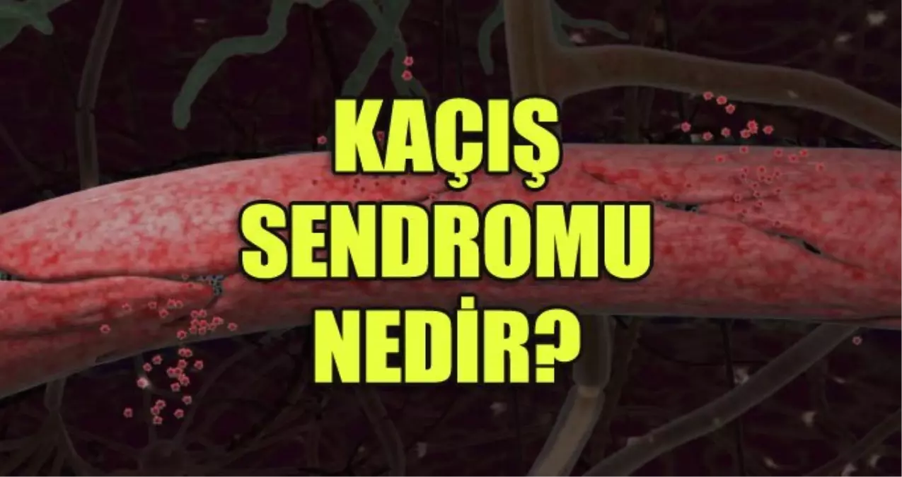 kacis-sendromu-nedir-belirtileri-nelerdir-nasil-tedavi-edilir-rDgMjeB8.jpg