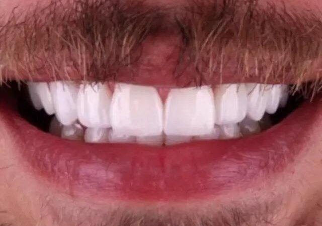 sihhatte-dunyanin-gundemi-dental-detox-e6eltsdB.jpg