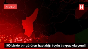 100-binde-bir-gorulen-hastaligi-beyin-baypasiyla-yendi-E3aHjgVs.jpg