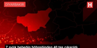 7-aylik-bebegin-bobreginden-40-tas-cikarildi-zQ9BwKbW.jpg