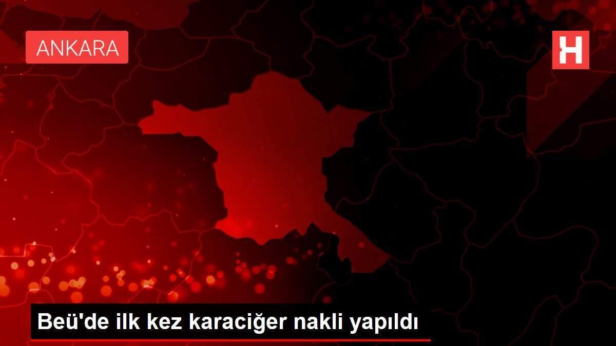 beude-birinci-sefer-karaciger-nakli-yapildi-lk6dHZnf.jpg