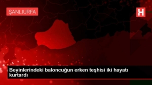 beyinlerindeki-baloncugun-erken-teshisi-iki-hayati-kurtardi-3Qj8J1E9.jpg