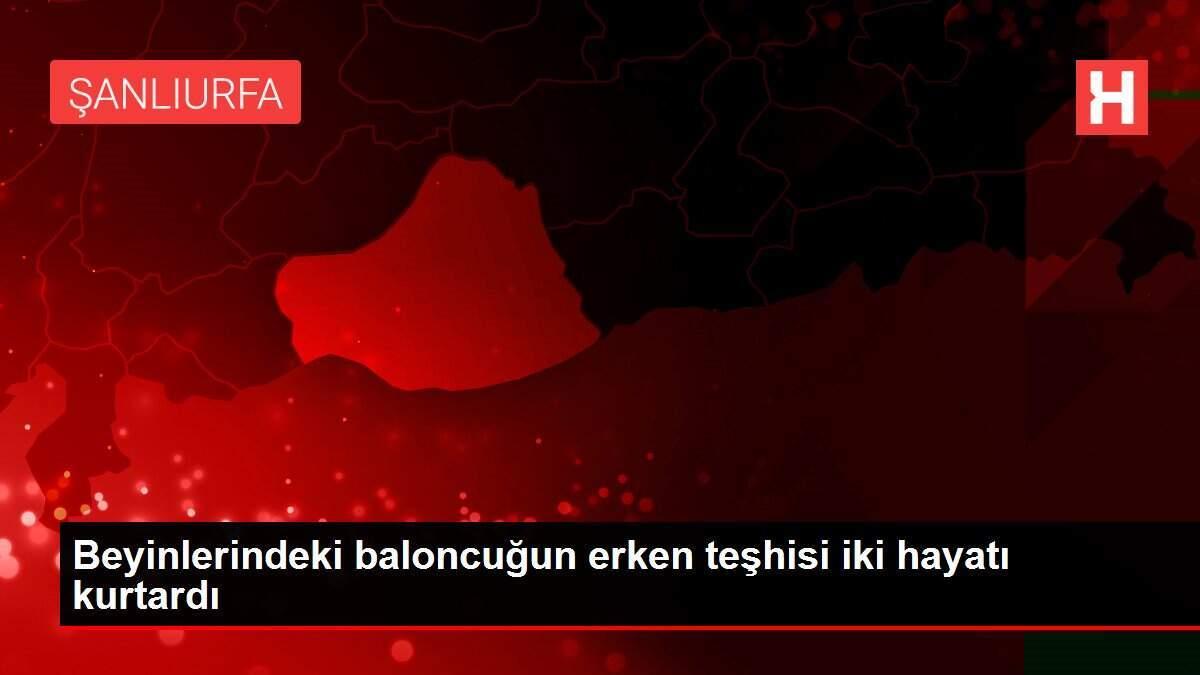 beyinlerindeki-baloncugun-erken-teshisi-iki-hayati-kurtardi-3Qj8J1E9.jpg