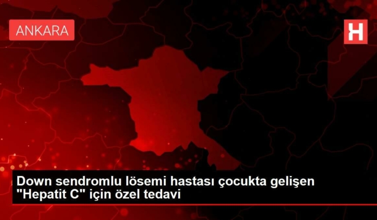 down-sendromlu-losemi-hastasi-cocukta-gelisen-hepatit-c-icin-ozel-tedavi-jKAQSh6w.jpg