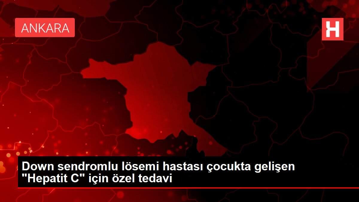 down-sendromlu-losemi-hastasi-cocukta-gelisen-hepatit-c-icin-ozel-tedavi-jKAQSh6w.jpg