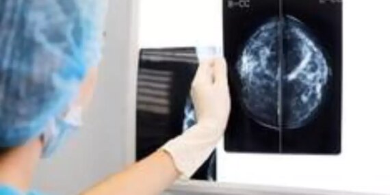 dunya-kanser-gunu-jingmei-li-gogus-kanserini-onlemek-icin-genetikten-yararlanan-doktor-1nHpkMdw.jpg