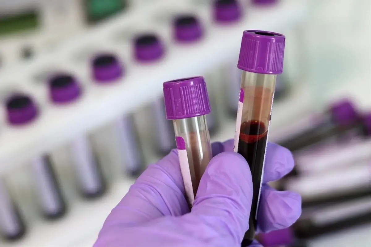 ferritin-nedir-ferritin-eksikligi-nedir-ferritin-ne-demek-ferritin-dusuklugu-nedir-DTdBYNvy.jpg
