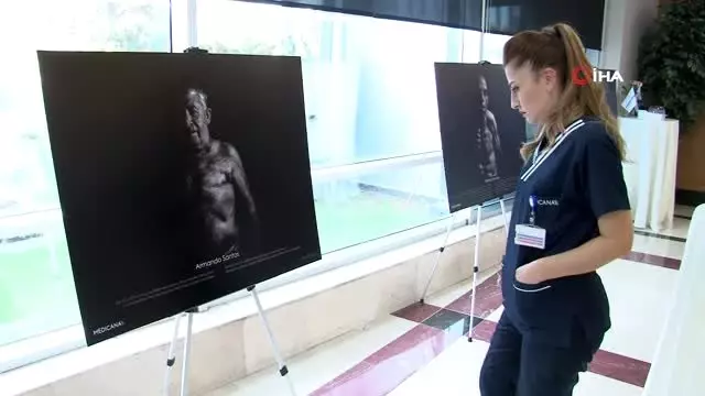 gogus-kanseri-erkeklerde-de-gorulebiliyor-rSsXeUja.jpg