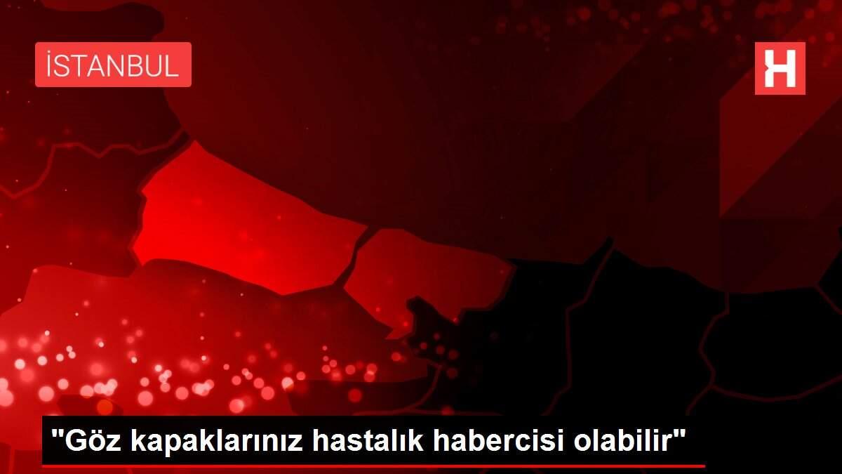 goz-kapaklariniz-hastalik-habercisi-olabilir-LnkG5j5J.jpg