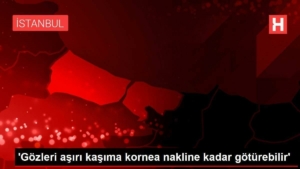 gozleri-cok-kasima-kornea-nakline-kadar-goturebilir-kpJ2lCcL.jpg