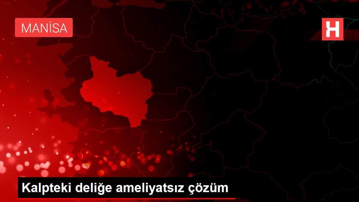 kalpteki-delige-ameliyatsiz-tahlil-ISNHknyl.jpg