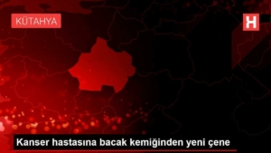 kanser-hastasina-bacak-kemiginden-yeni-cene-S2skFKYO.jpg