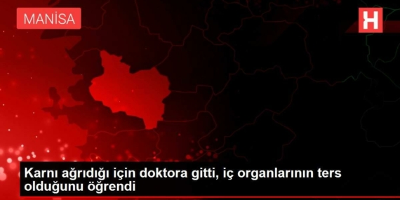 karni-agridigi-icin-doktora-gitti-ic-organlarinin-karsit-oldugunu-ogrendi-n9X6LzV2.jpg