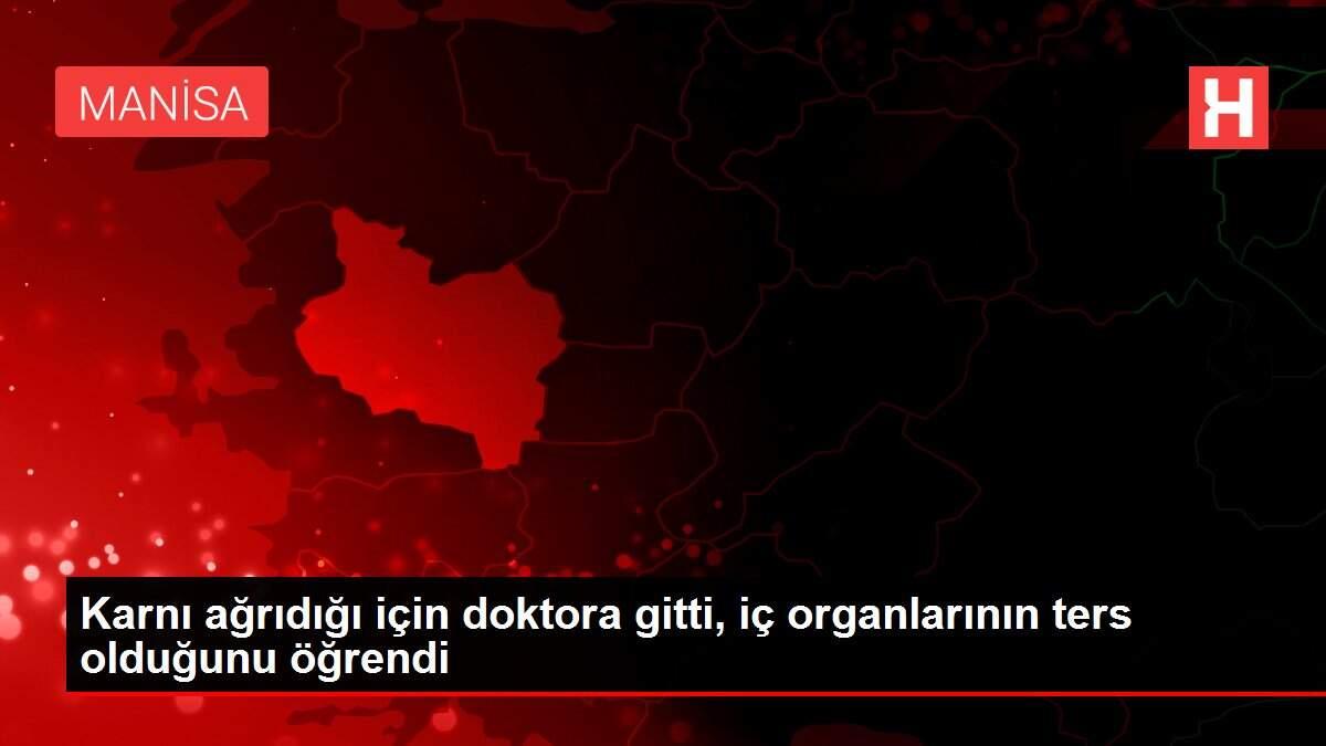karni-agridigi-icin-doktora-gitti-ic-organlarinin-karsit-oldugunu-ogrendi-n9X6LzV2.jpg