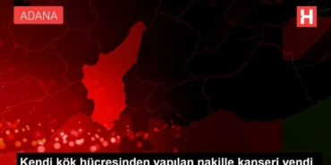 kendi-kok-hucresinden-yapilan-nakille-kanseri-yendi-gMtpCL7p.jpg