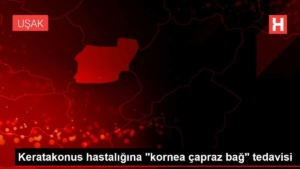 keratakonus-hastaligina-kornea-capraz-bag-tedavisi-xT4HjQzw.jpg