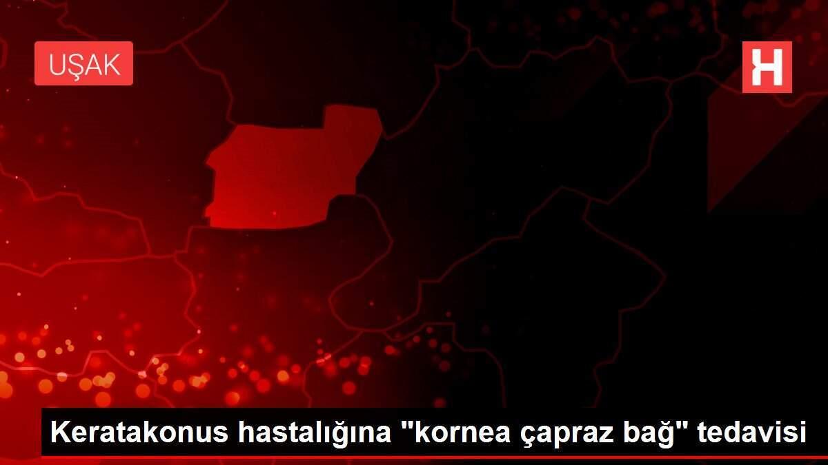 keratakonus-hastaligina-kornea-capraz-bag-tedavisi-xT4HjQzw.jpg