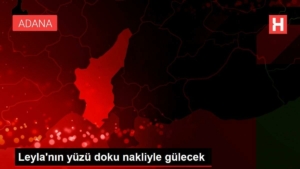 leylanin-yuzu-doku-nakliyle-gulecek-6ZCCcsez.jpg