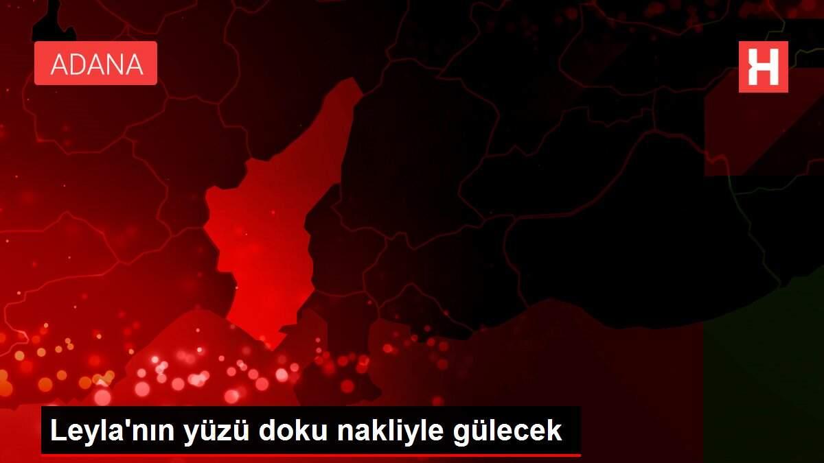 leylanin-yuzu-doku-nakliyle-gulecek-6ZCCcsez.jpg