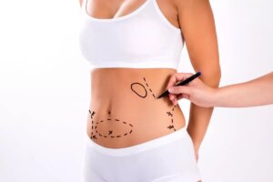 liposuction-hakkinda-bilmeniz-gerekenler-HP3E6CSS.jpg