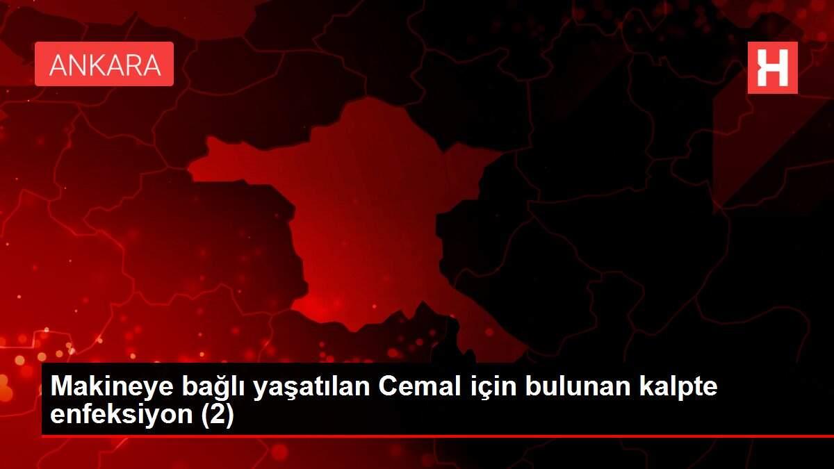 makineye-bagli-yasatilan-cemal-icin-bulunan-kalpte-enfeksiyon-2-QWHSxUdp.jpg
