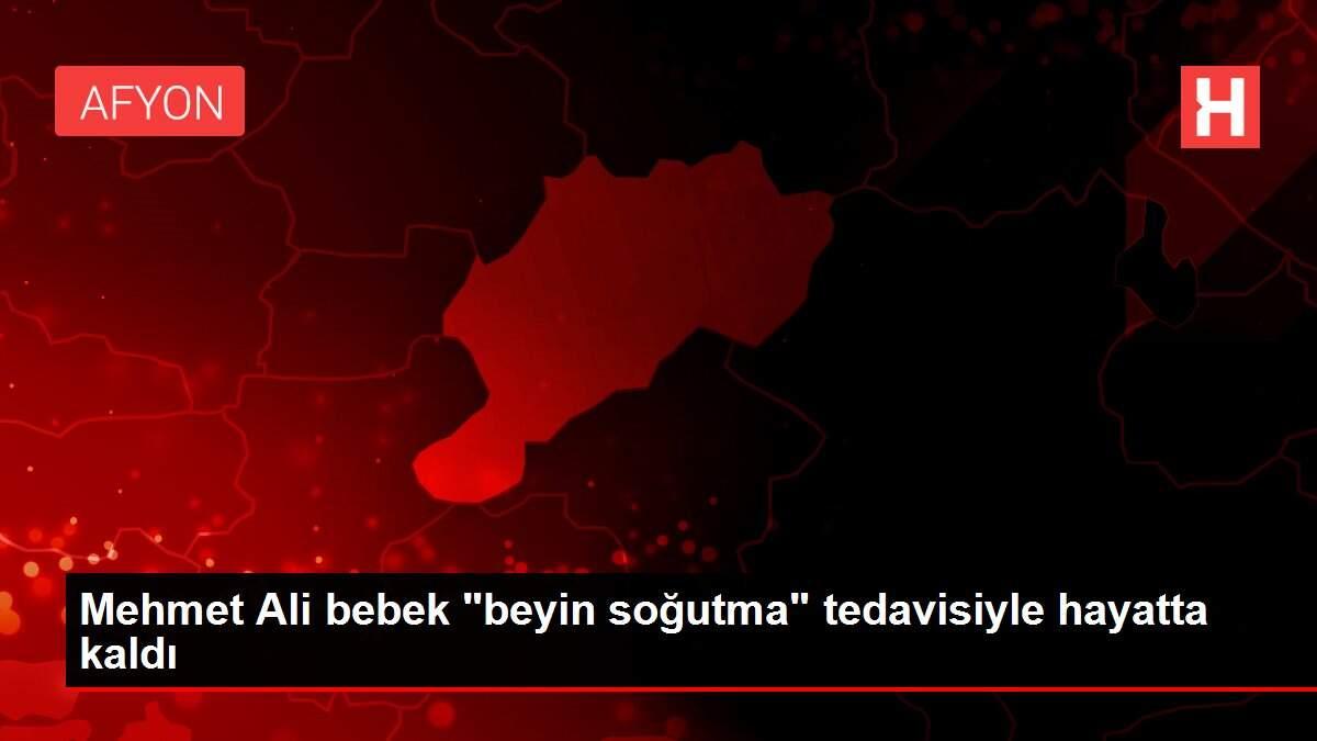 mehmet-ali-bebek-beyin-sogutma-tedavisiyle-hayatta-kaldi-Ls3gaGg9.jpg