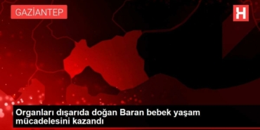 organlari-disarida-dogan-baran-bebek-omur-gayretini-kazandi-fQFJwn6F.jpg