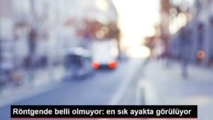 rontgende-asik-r-olmuyor-en-sik-ayakta-goruluyor-rrxAeydW.jpg