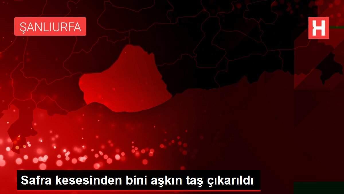 safra-kesesinden-bini-askin-tas-cikarildi-AGQJVpfy.jpg