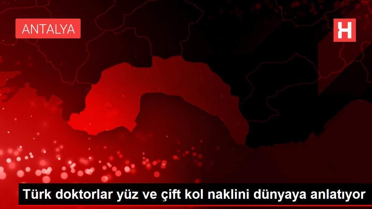 turk-tabipler-yuz-ve-cift-kol-naklini-dunyaya-anlatiyor-83ehnMdp.jpg