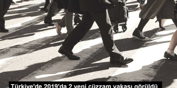 turkiyede-2019da-2-yeni-cuzzam-hadisesi-goruldu-I4bEL1Iz.jpg
