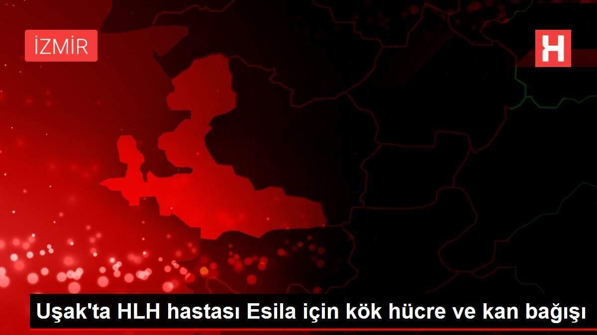 usakta-hlh-hastasi-esila-icin-kok-hucre-ve-kan-bagisi-Ezbx9a6W.jpg