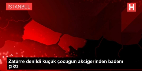 zaturre-denildi-kucuk-cocugun-akcigerinden-badem-cikti-4diXVyXD.jpg