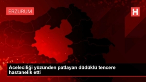 aceleciligi-yuzunden-patlayan-duduklu-tencere-hastanelik-etti-GM3TIFiX.jpg