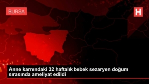 anne-karnindaki-32-haftalik-bebek-sezaryen-dogum-sirasinda-ameliyat-edildi-GgMqIwXC.jpg