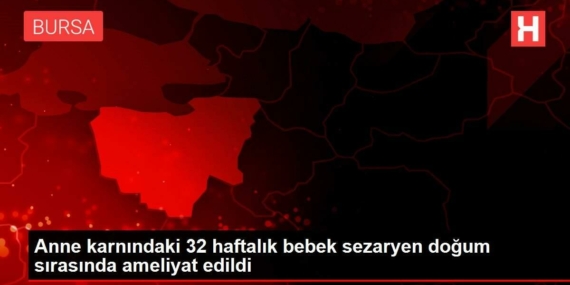 anne-karnindaki-32-haftalik-bebek-sezaryen-dogum-sirasinda-ameliyat-edildi-GgMqIwXC.jpg